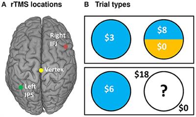 Reduced Risk-Taking following Disruption of the Intraparietal Sulcus